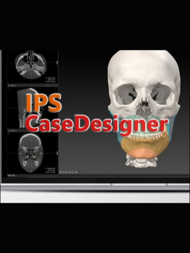 IPS Case Designer - گلد اپ