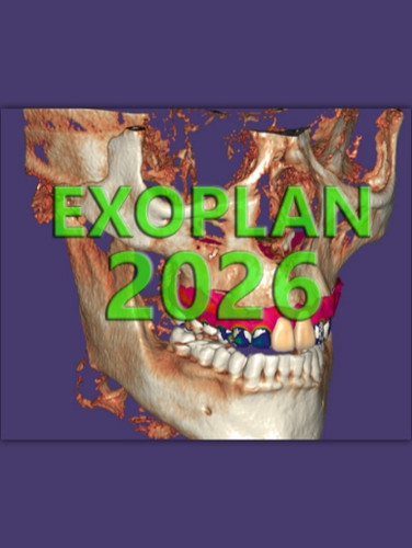 ExoPlan 3.1 - 2026 - GOLDAP.IR گلد اپ